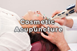 Milton Naturopath Cosmetic Acupuncture